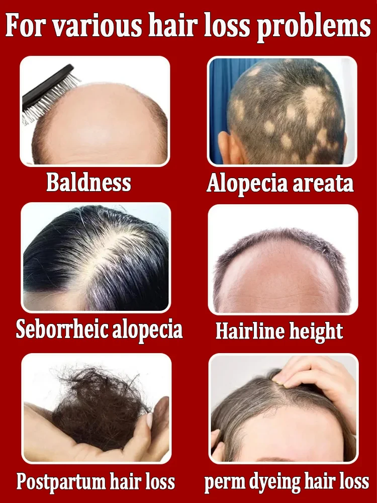 El producto para el crecimiento del cabello más vendido en Asia. A partir de hoy, ya no tendrás problemas con la caída del cabello ni la calvicie. Encuentra tu mejor versión