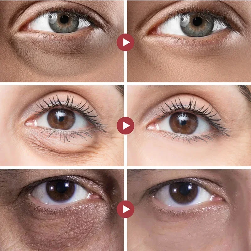 Crema para ojos con Retinol, elimina las ojeras, bolsas para los ojos, hinchazón, reduce las arrugas, suero para los ojos, eliminación de ojeras, cuidado de los ojos para hombre y mujer