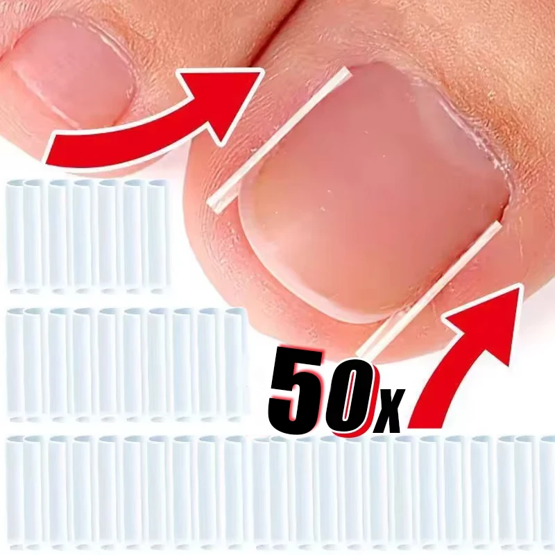 50 Pz Strumento di Correzione dell'unghia del piede incarnita Invisibile Trattamento delle unghie dei piedi incarnite Pad Scanalatura Raddrizzamento Clip Brace Strumento di cura del piede
