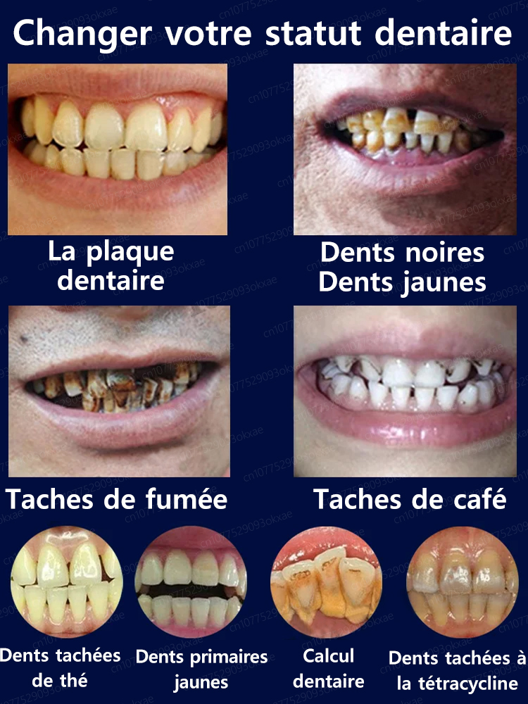 Blanchiment des dents, restauration rapide et naturelle des gencives, avis utilisateurs extrêmement positifs