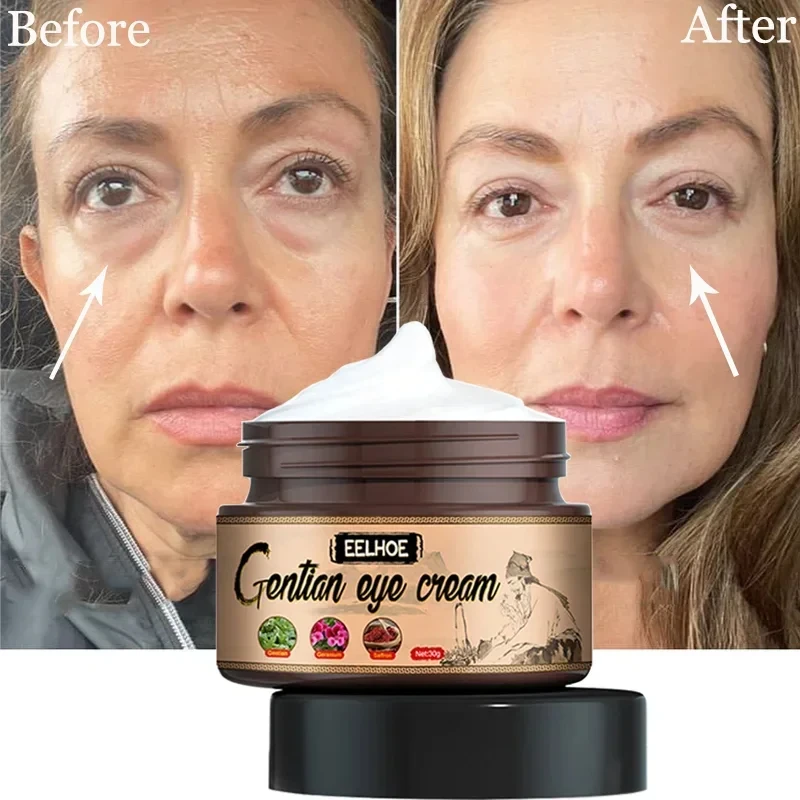 Creme para os olhos melhora a bolsa dos olhos desbota linhas finas remove grânulos de gordura levantamento endurecimento hidratante anti-inchaço soro de cuidados com a pele dos olhos