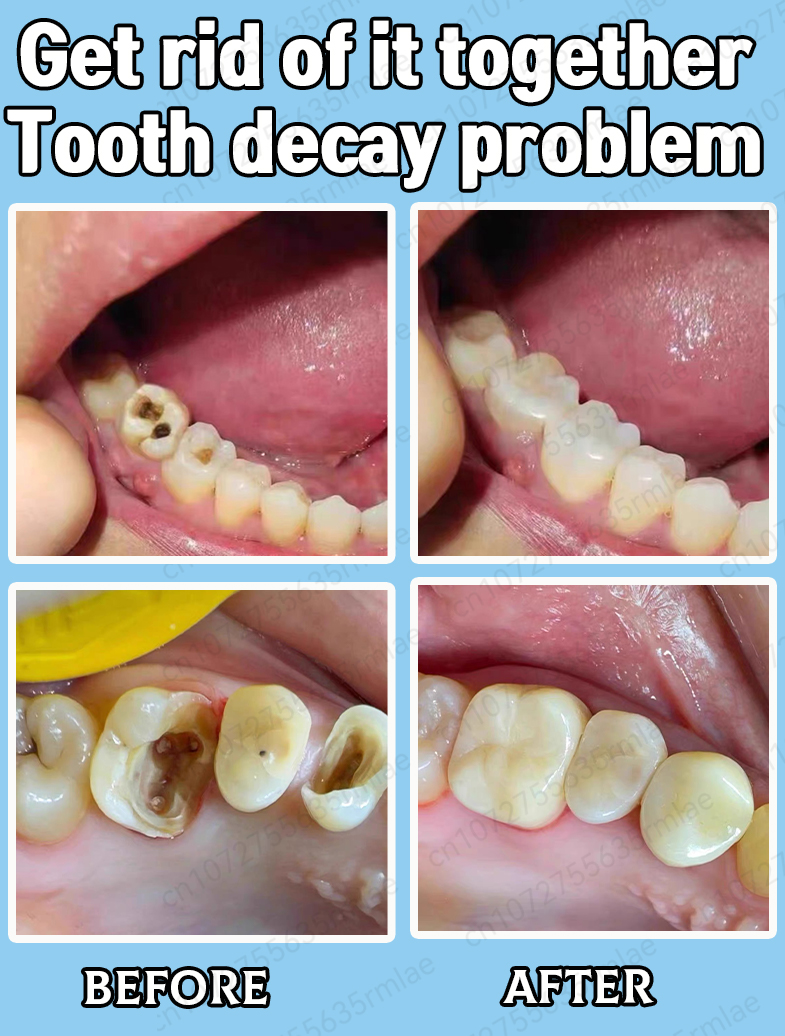 Reparar las caries, eliminar el dolor de muelas, restaurar y blanquear los dientes.