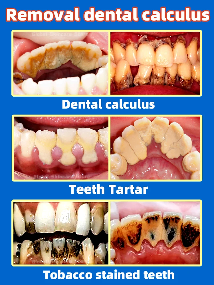 Resuelve problemas dentales