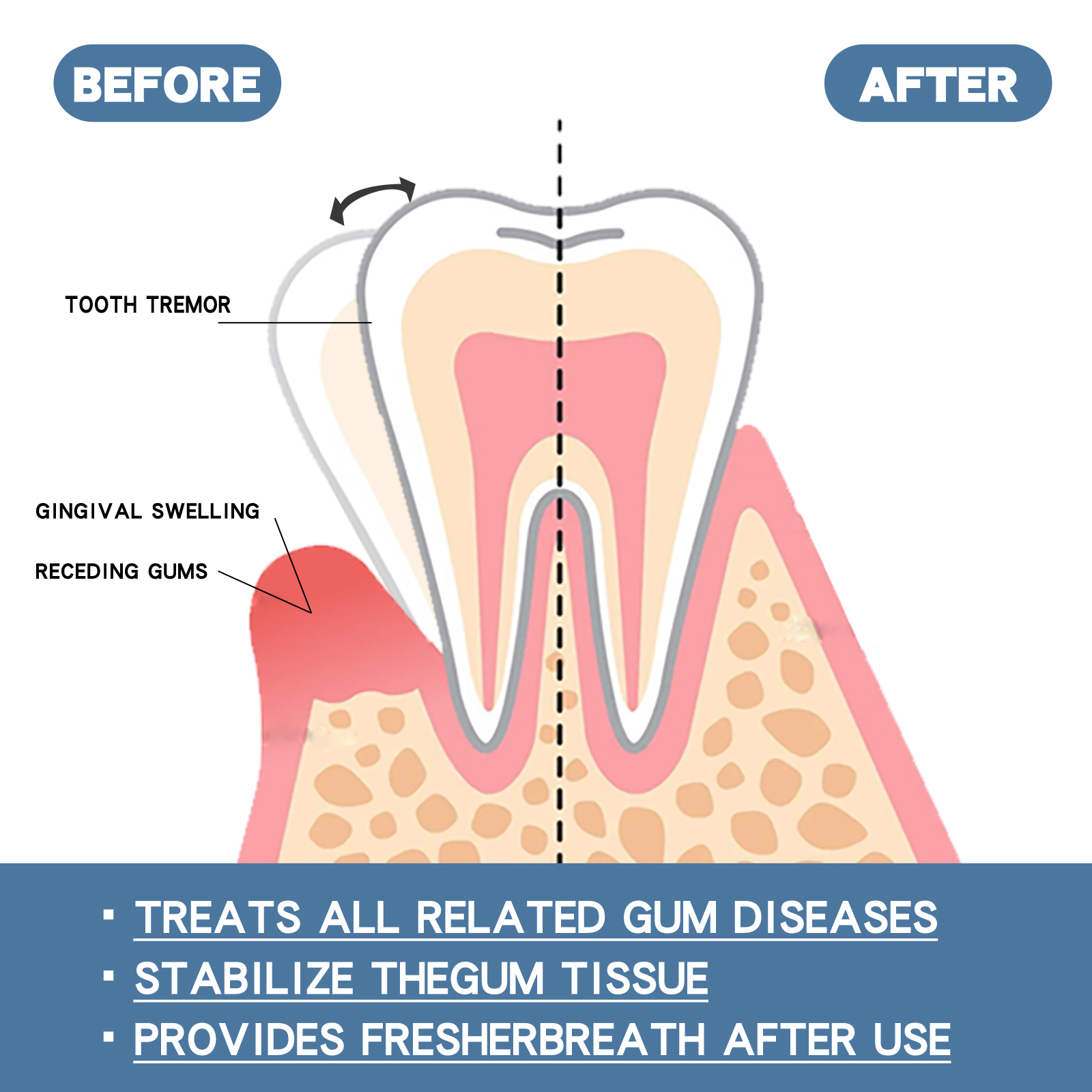 Rapid Repair Gums Serum Effectively Relieve Tooth Allergy Dental Caries Tooth Cleaning Toothpaste Relieve Tooth  Damage Drops