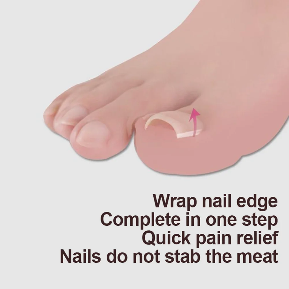 10 sztuk wrastający paznokieć narzędzie do korekcji wrastający palec u nogi leczenie elastyczna łatka naklejka klips do prostowania Brace Pedicure narzędzie