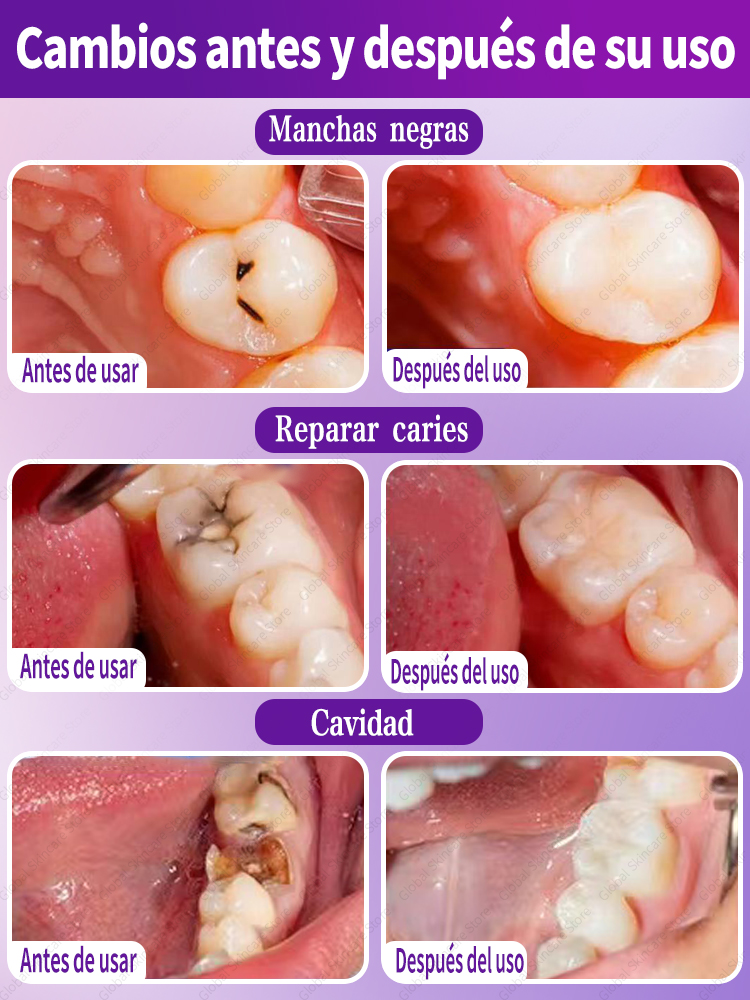 tooh Reparación de decay