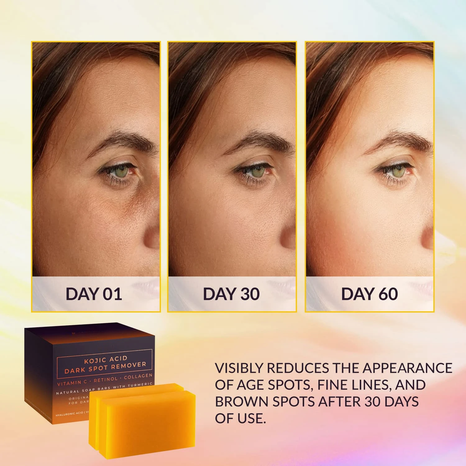 Kojiczuur Donkere Vlek Remover Whitening Zeep Handgemaakte Huidverzorging Diepe Reiniging Hydraterende Reiniging Essentiële Zeep Fleuren Huid