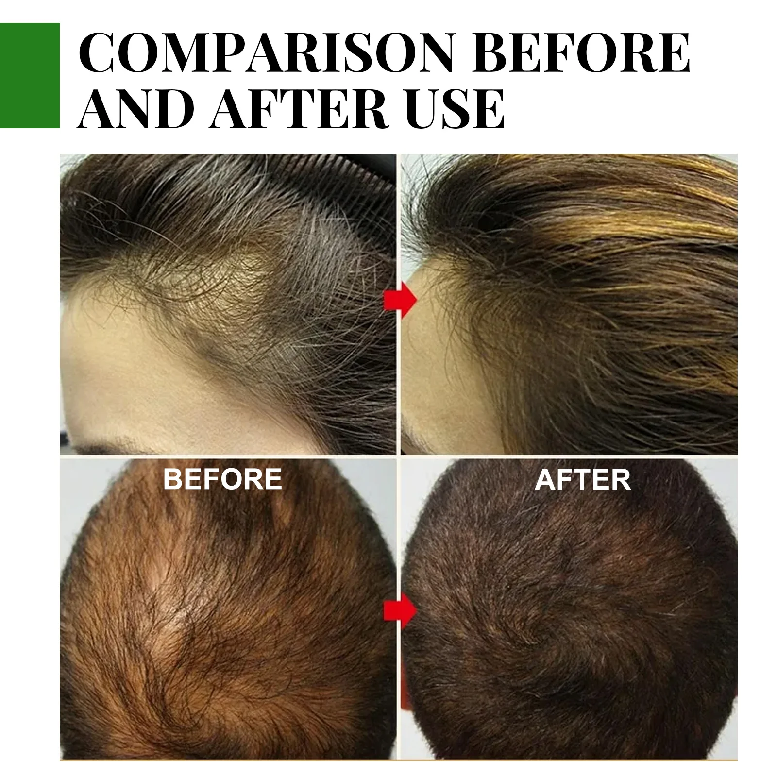 Óleo essencial de alecrim para cuidados com os cabelos, nutre o couro cabeludo, evita a perda de cabelo, fortalece as raízes do cabelo, produto orgânico natural para cuidados com os cabelos