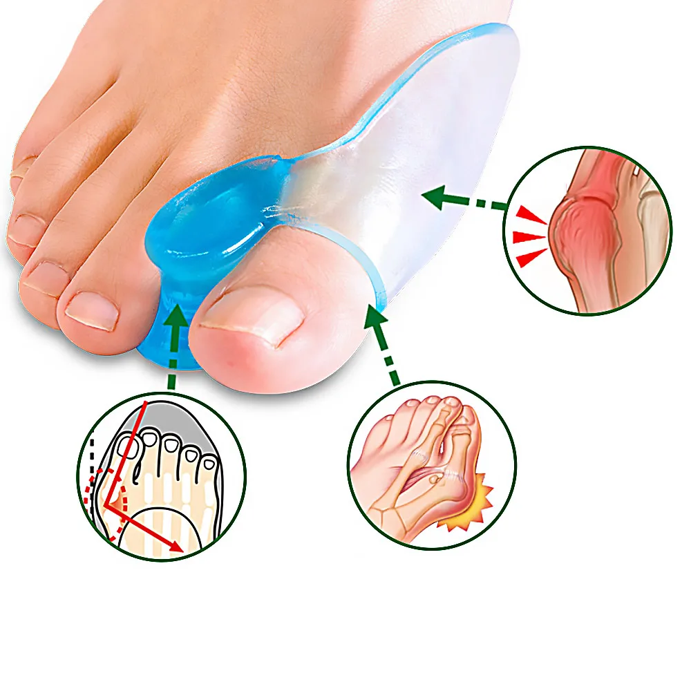 1pair Silicone Toe Separator Silicone Gel Thumb Corrector Bunion Little Toe Protector Hallux Valgus Foot Care Relief Pads