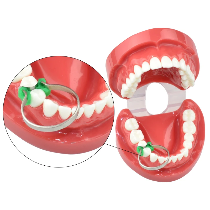 Dentist Fillings Matrix Holder Clamp Matrices Placement Tweezer Dental Sectional Matrix Contoured Metal Matrices Bands
