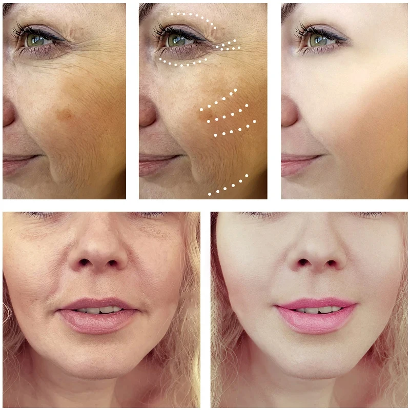 Сыворотка для улучшения шероховатости, разглаживания кожи лица