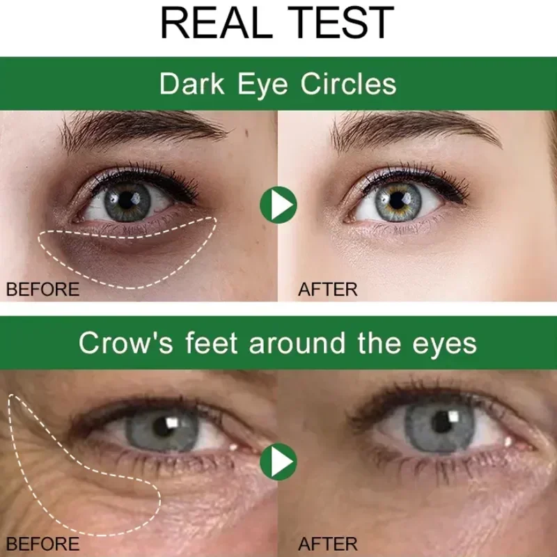 Crema para los ojos con arrugas de 7 días, antiojeras, hinchazón, líneas finas, blanqueamiento, cuidado coreano de la piel, novedad de 2023