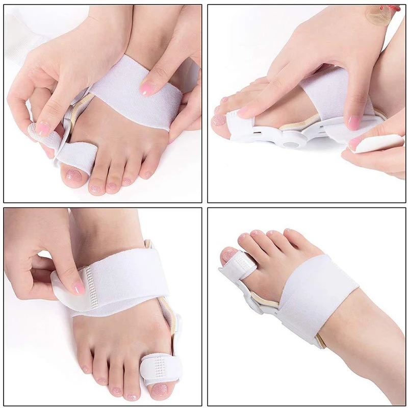 2 pçs grande osso dedo do pé joanete tala alisador corrector pé para cuidados com os pés protetor hálux valgus alívio da dor ferramentas de cuidados com os pés