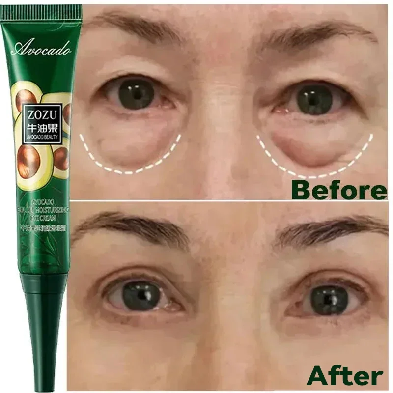 Crema para los ojos con arrugas de 7 días, antiojeras, hinchazón, líneas finas, blanqueamiento, cuidado coreano de la piel, novedad de 2023