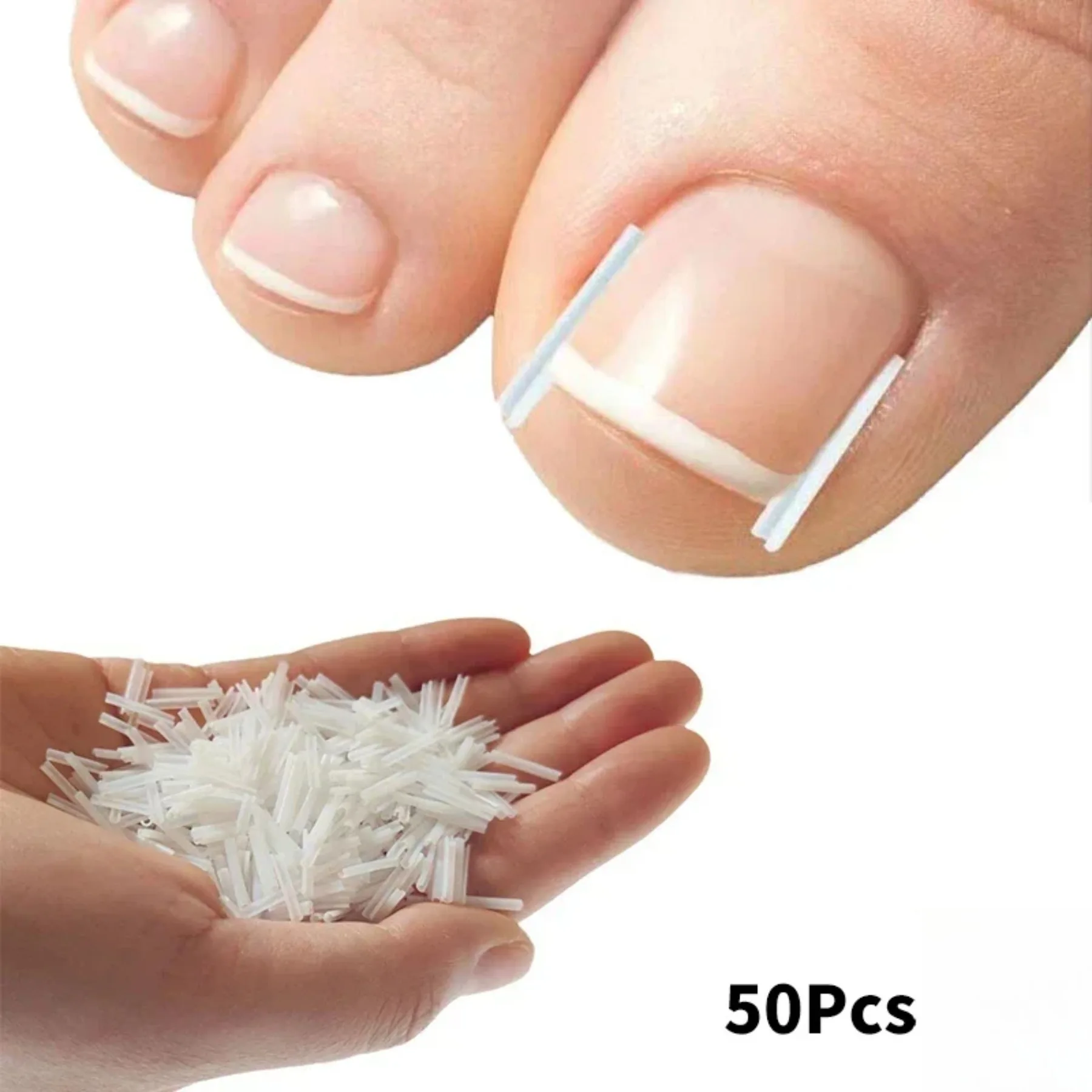 Ferramenta de correção de unha encravada, 50 peças, tratamento de unhas encravadas, adesivo elástico, clipe de alisamento, ferramenta de pedicure