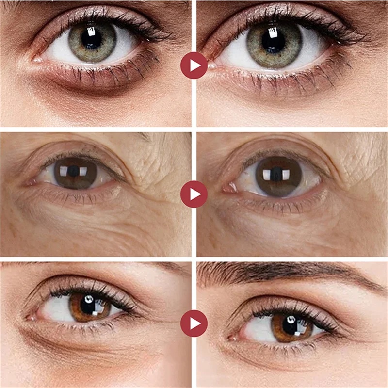 Crema de eliminación instantánea de bolsas de ojos, colágeno, antiarrugas, decoloración de líneas finas, reafirmante de la piel, anticírculo oscuro, hinchazón, ilumina el cuidado de los ojos