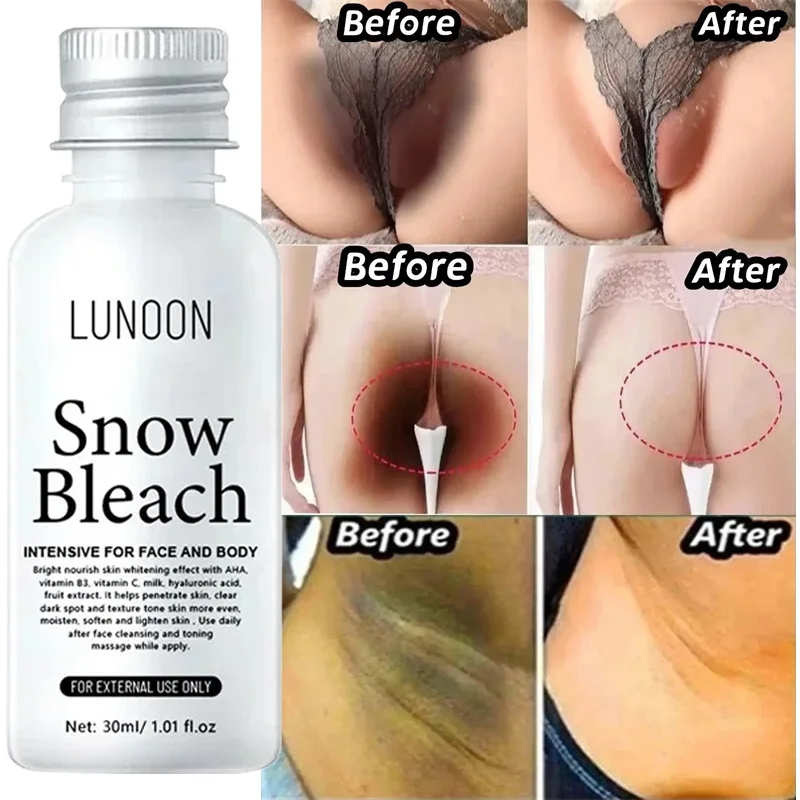 Creme de clareamento partes íntimas axilas soro de branqueamento clarear bunda joelho iluminar parte interna da coxa peças íntimas escuro remover melanina