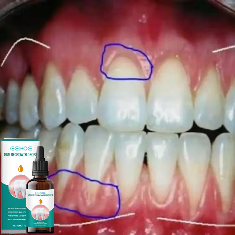 Quickly Repair Gum Serum Relieve Receding Gum Regrowth Drops Teeth Whiten Remove Yellow Plaque Stains Decay Toothache Toothpaste