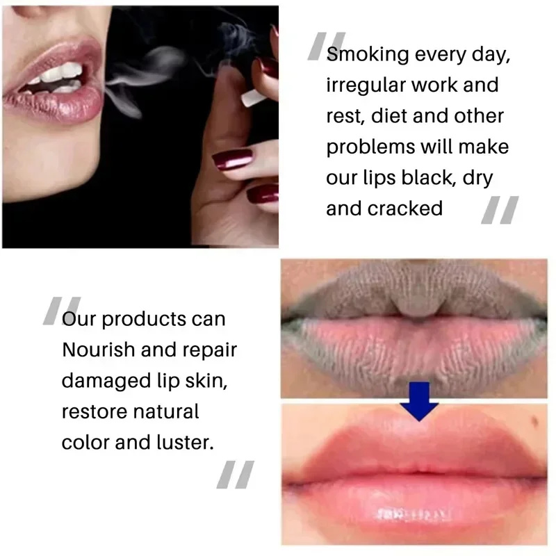 Mascarilla de labios oscura, aclaramiento rápido, exfoliante de labios rosa, línea de labios que se desvanece, crema hidratante para la piel muerta, productos de cuidado coreano, belleza y salud