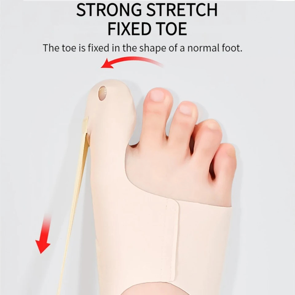 Corrector de juanete para aliviar el Hallux Valgus, separador del dedo gordo del pie, alisador del dedo gordo del pie fijo, alivio del dolor en las articulaciones, 1 Uds.