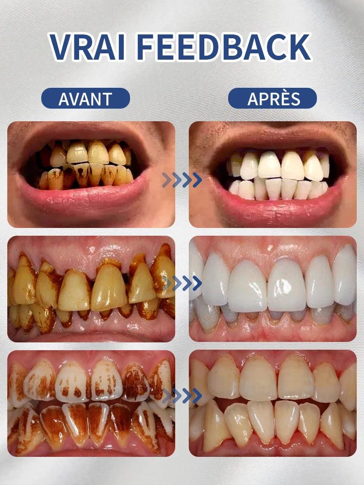 Résout tous les problèmes dentaires