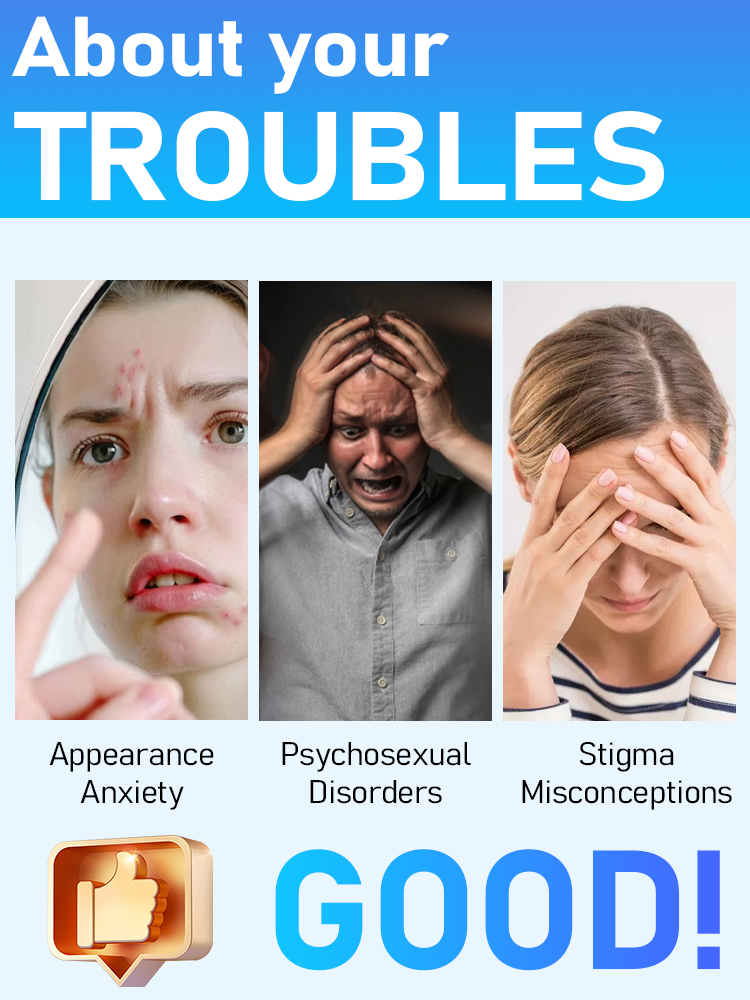 2025 New Upgrade Blue Laser Solve Wart Tool