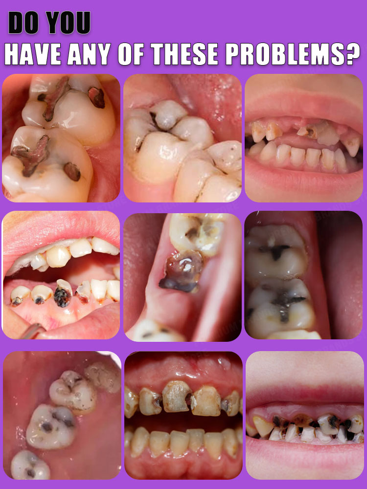 caries reparar todas las caries dentífrico Proteger los dientes