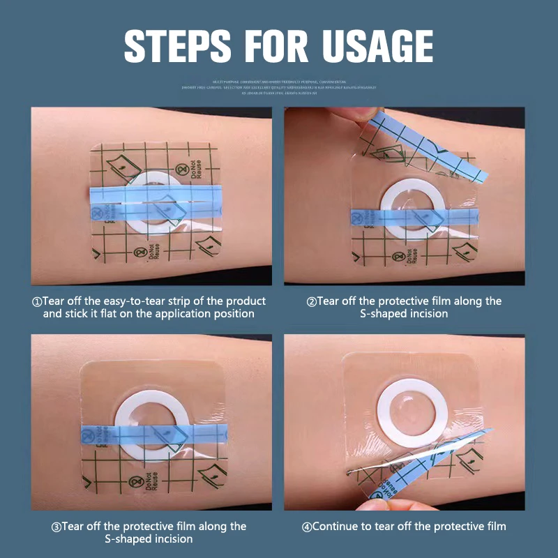 10ชิ้นเทปใสทางการแพทย์ฟิล์ม PU กาวปูนปลาสเตอร์กันน้ำกันอาการแพ้ยาแก้แผลติดสะดือ