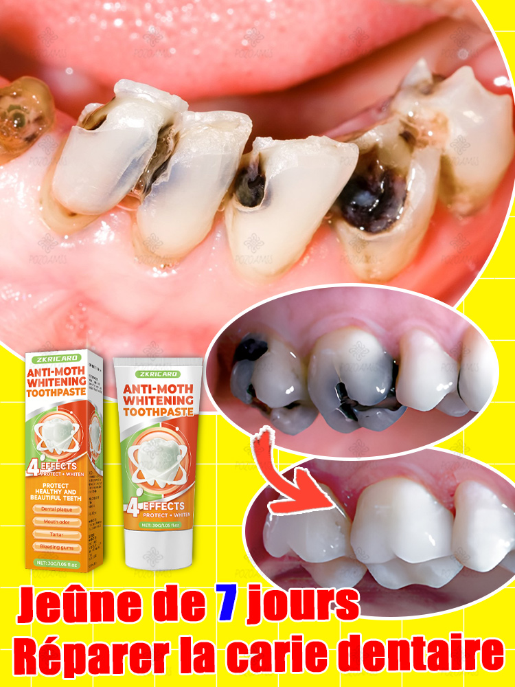 Réparer la carie dentaire, soulager la douleur des gencives, blanchiment des dents