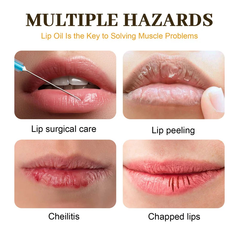 Fast Lightening Pink Mouth Lips Serum Bleaching Permanent Remove Dark Smoke Lips Lip Balm Moisturize Gloss Lipstick Lip Mask