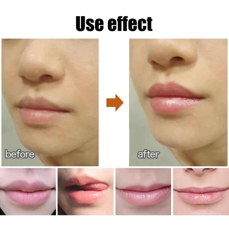 Bálsamo labial fofo em forma de bola – Hidratante, calmante e labial de longa duração com copo antiaderente para evitar rachaduras no gelo