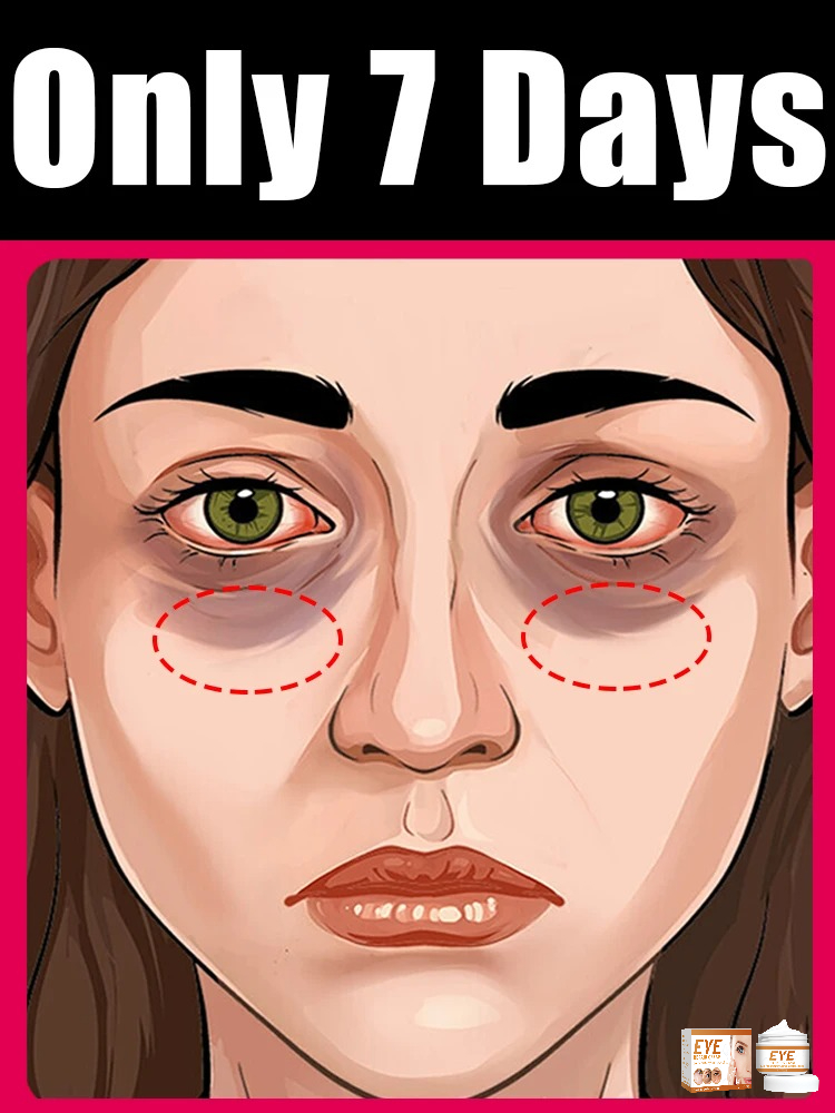 Продам крем для глаз, удаляющий морщины, мешки под глазами, темные круги, против отеков, укрепляющий, осветляющий, тонкие линии, увлажняющий инструмент