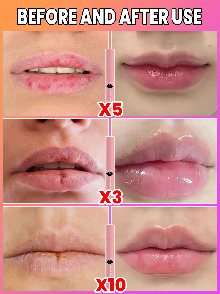 Professional and gentle formula instantlyplumps your lips and makes every smilemore charming
