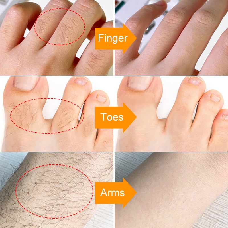 Женская/Мужская эпиляция для лица и подмышек