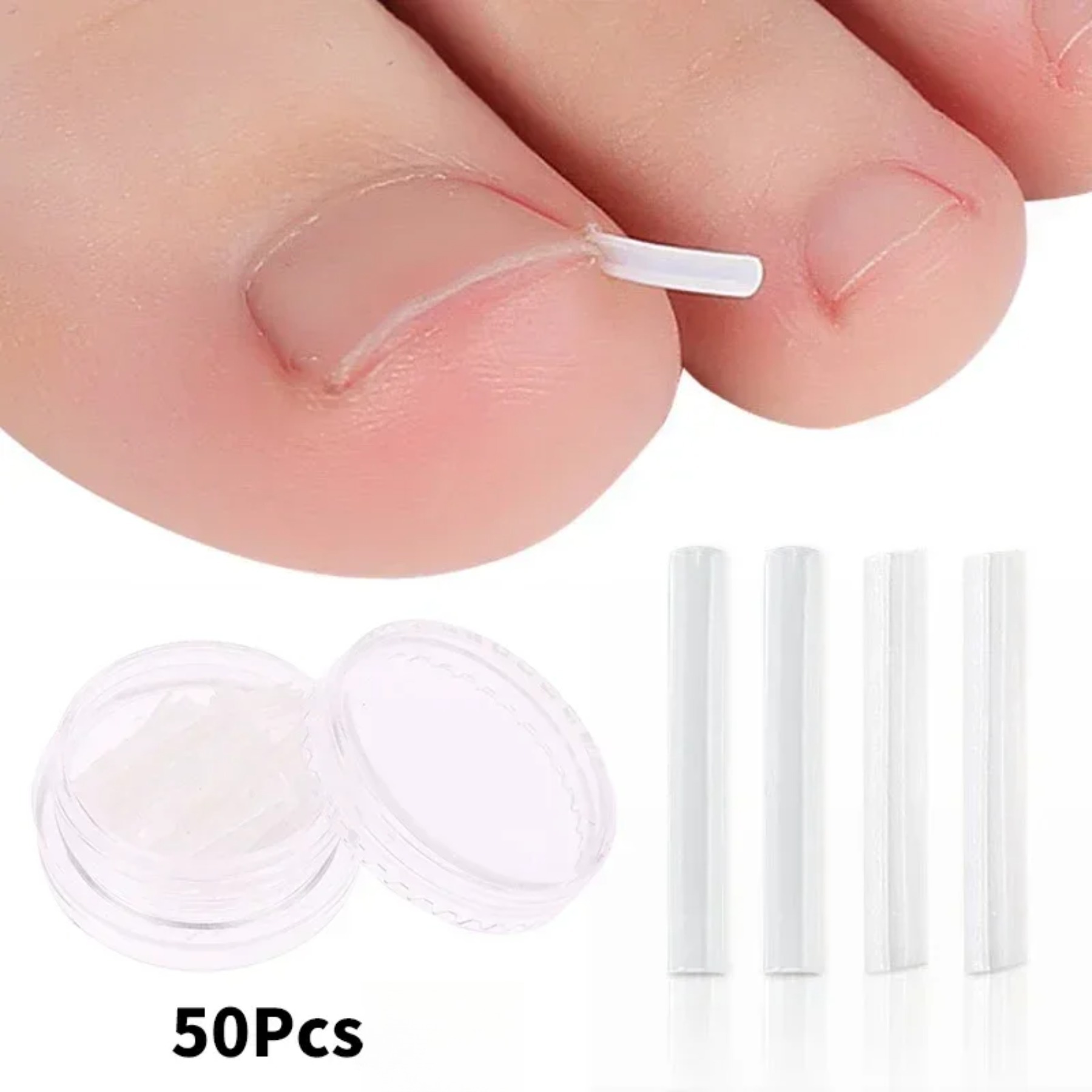 50Pcs Ingrown Toenail Tool Ingrown Toe Nail Treatment Elastic Patch Sticker Straightening Clip Brace Pedicure Tool