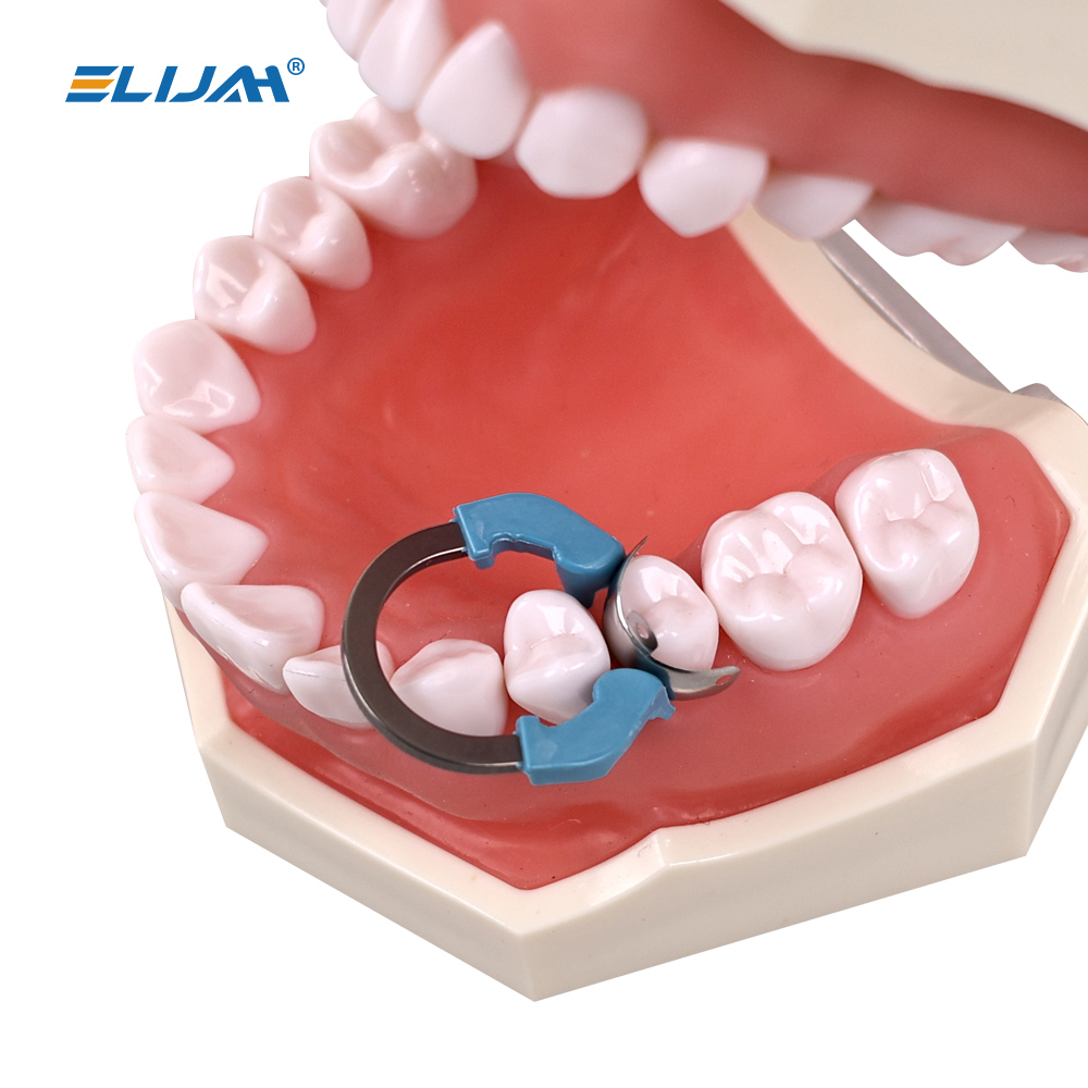ทันตกรรม Matrix Bands คลิป NITI Matrix Clamp แหวน Clamp ตัดโค้งเมทริกซ์นิกเกิลไทเทเนียมแหวนหนีบเครื่องมือทันตแพทย์