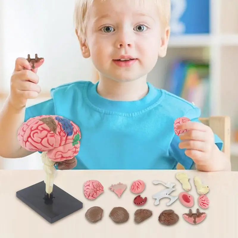 3D Brain Model Teaching Med Model Anatomical Model With Display Base Color-Coded Artery Brain DIY Teaching Anatomy Model For