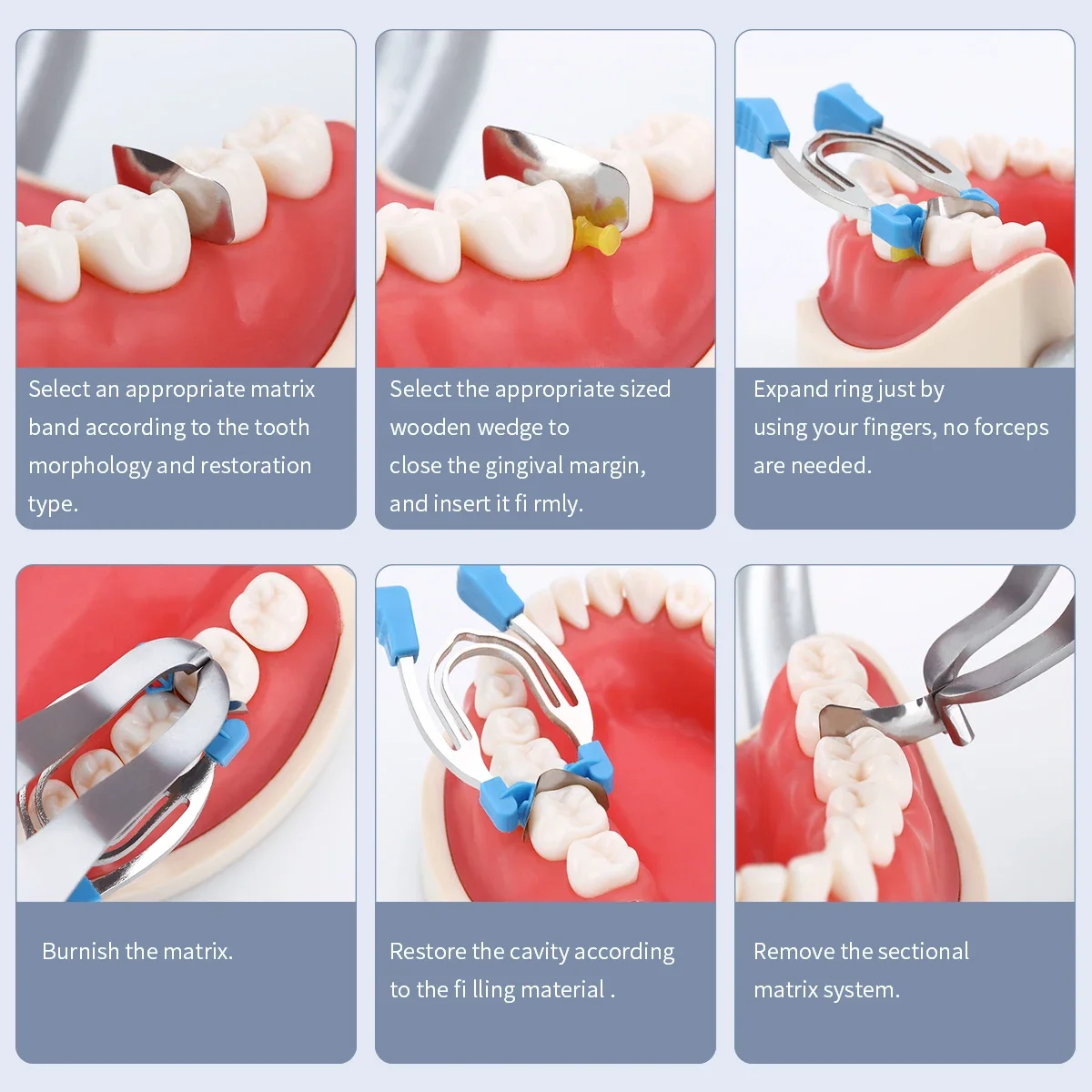 Matryca dentystyczna Matryce segmentowe Zaciski Kliny Metalowe sprężynowe pierścienie zaciskowe Narzędzia dentystyczne Instrument laboratorium dentystycznego