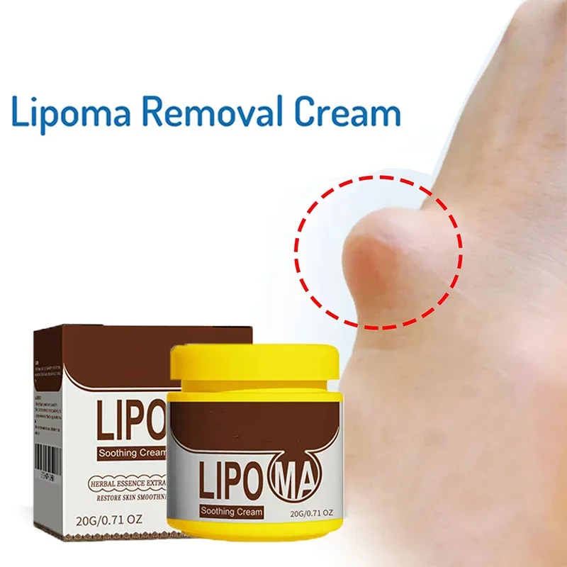 Crema calmante removedor de grumos subcutáneos