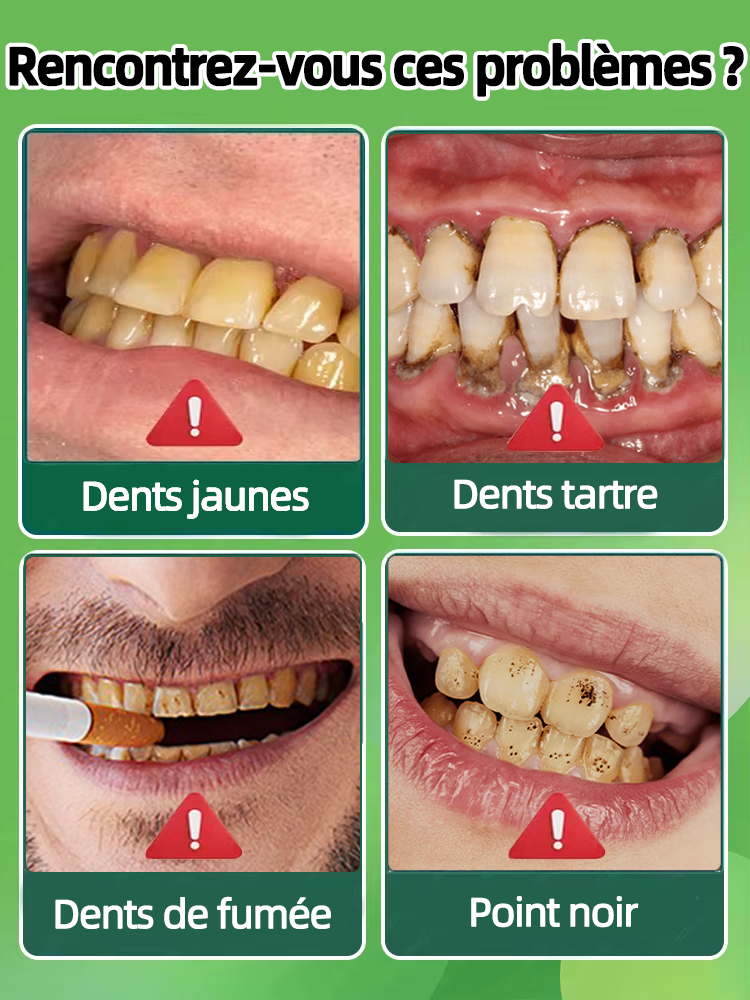 Blanchiment des dents, élimination du tartre