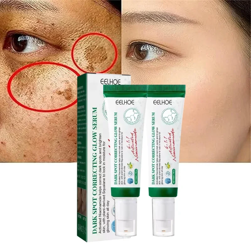 Crema correctora de manchas oscuras que reduce las manchas oscuras, el cuidado iluminador, hidrata y nutre la piel, reduce la melanina, desvanece las manchas, las pecas