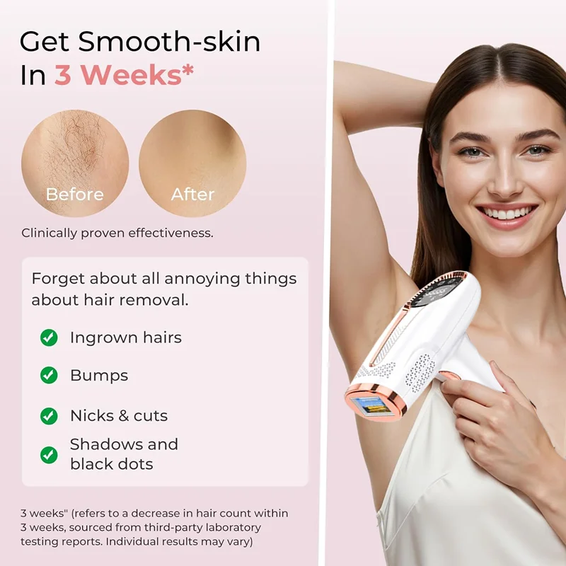 4-in-1 Laser Epilator Laser Heet Verkoop Permanente IPL Photoepilator Ontharing Pijnloze Elektrische Epilator Machine