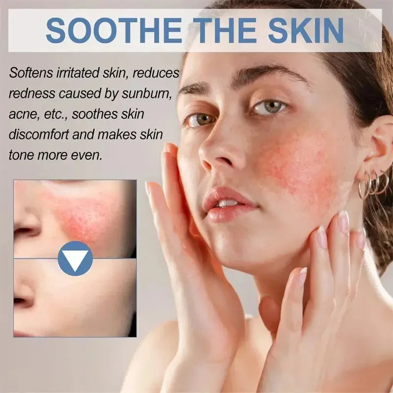 Crema reparadora de enrojecimiento Facial mejora la sequedad de la piel sensible crema hidratante loción calmante eliminación Rosacea Cosméticos Coreanos