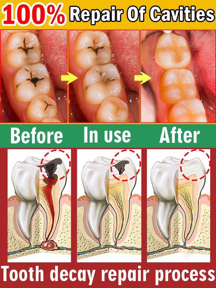 99 % der Menschen werden dieses Hohlraum-Reparatur-Mousse wiederverkauf