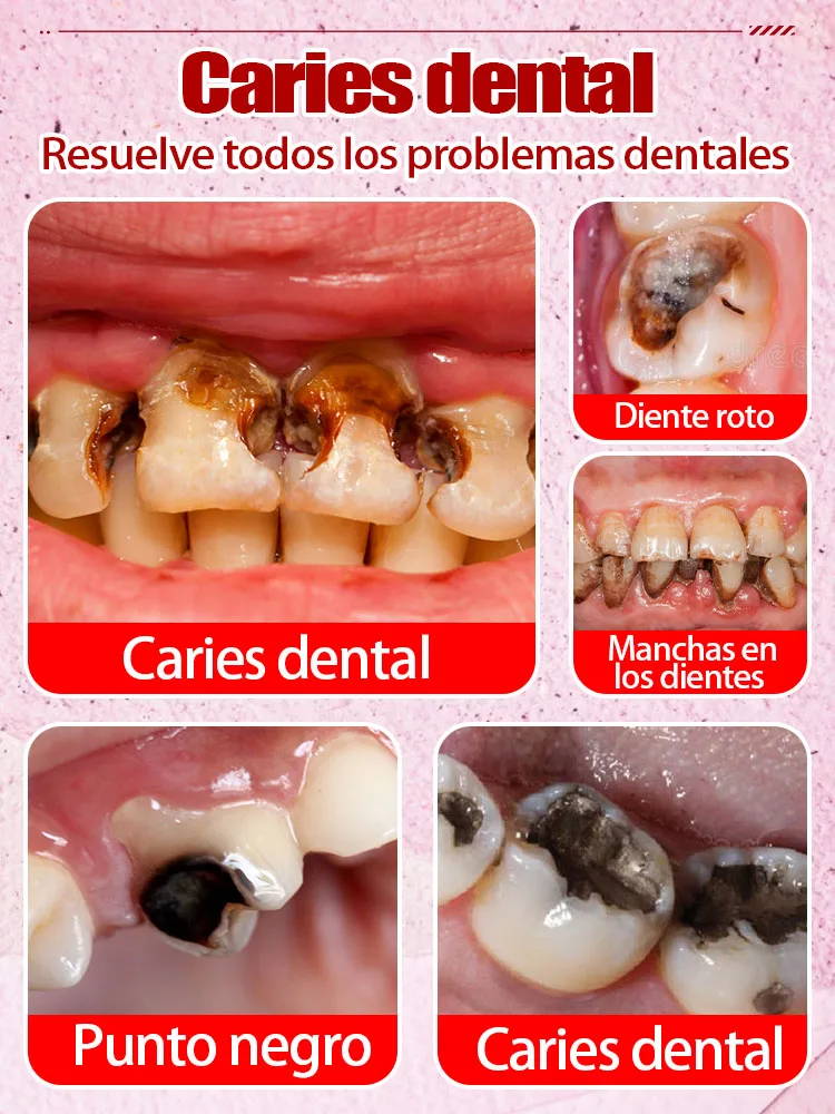 Reparar caries, caries dental, aliviar dolor de encías, blanqueamiento dental