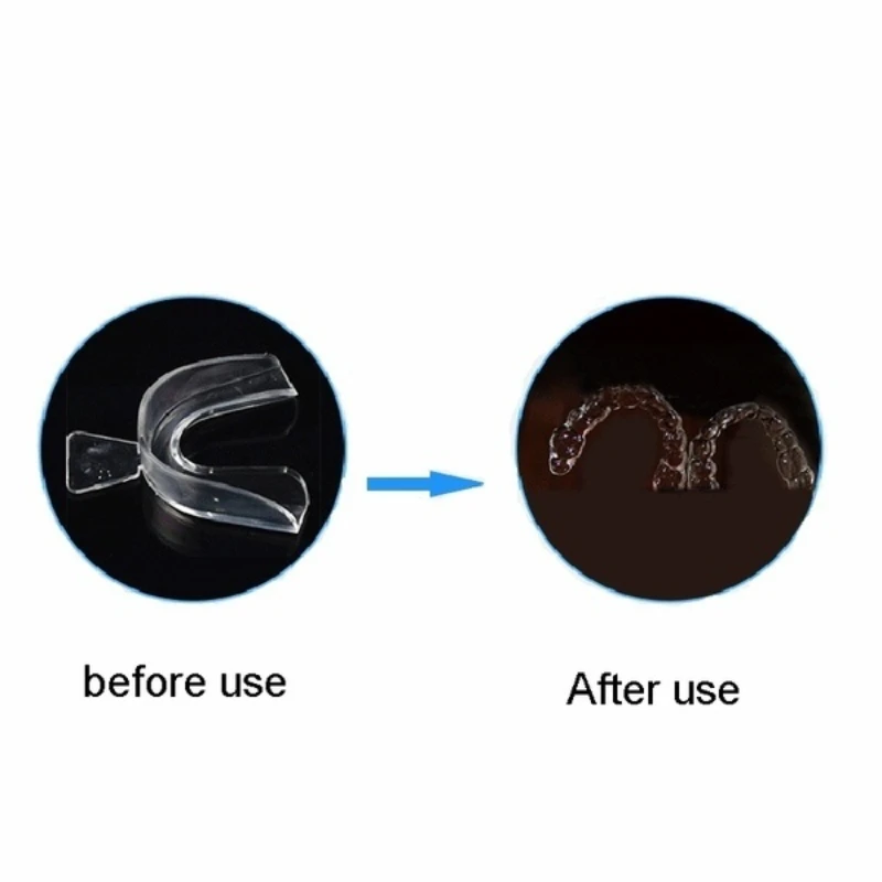 1/2/4 Uds Anti ronquidos bruxismo protector bucal para dormir protector nocturno protector de encías bandeja bucal para detener el rechinar los dientes ayuda para el sueño cuidado de la salud