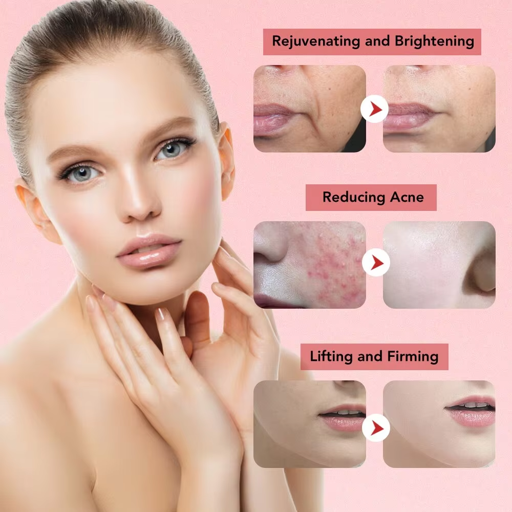 ฟื้นฟูผิว EMS RF ผู้หญิงนวดหน้า 7 in 1 Face Microcurrent Facial Massager Light Therapy Anti Aging ริ้วรอยความงาม
