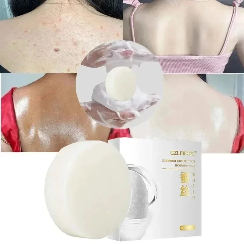Body Whitening SOAP สบู่ฟอกสีเข่าใต้วงแขน กําจัดผิวไก่ กําจัดจุดด่างดํา ผิวที่ตายแล้ว ชุ่มชื่น กระจ่างใส Body Care