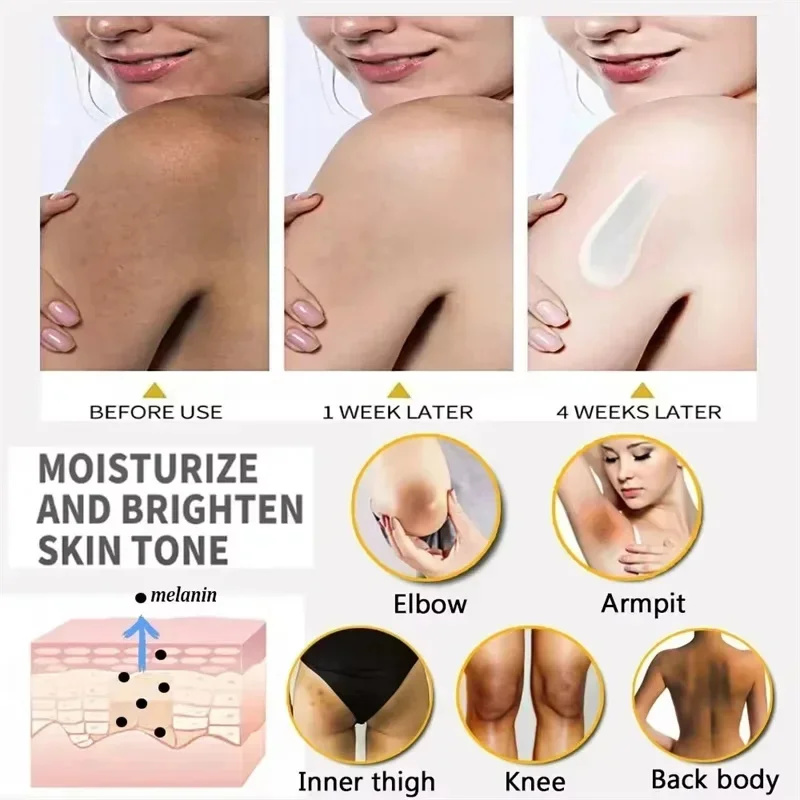 Crema para blanquear el cuerpo, partes privadas, suero blanqueador de axilas, blanqueador de glúteos, rodilla, ilumina la parte interna del muslo, íntimo, oscuro, elimina la melanina