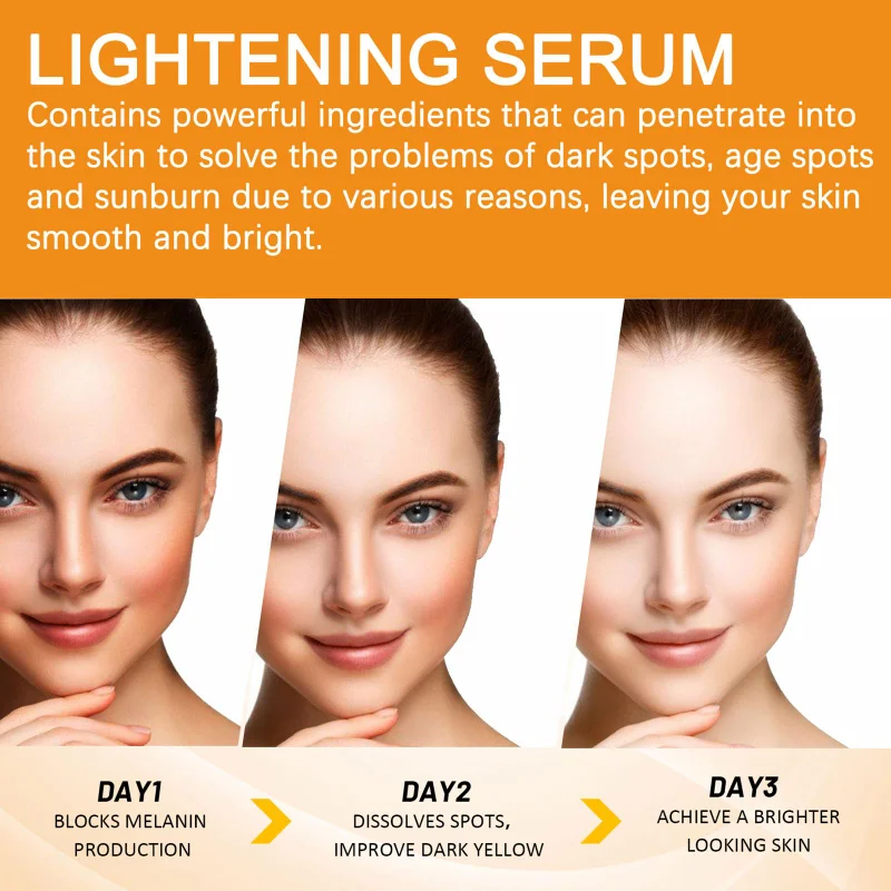 Soro de vitamina c para clareamento facial, soro facial com ácido hialurônico, removedor de manchas escuras, produtos coreanos para cuidados com a pele